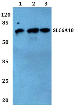 Invitrogen SLC6A18 Polyclonal Antibody 100 &mu;L; Unconjugated:Antibodies,