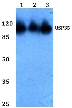 Invitrogen USP35 Polyclonal Antibody 100 &mu;L; Unconjugated:Antibodies,