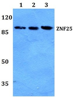 Invitrogen ZNF25 Polyclonal Antibody 100 &mu;L; Unconjugated:Antibodies,