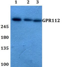 Invitrogen GPR112 Polyclonal Antibody 100 &mu;L; Unconjugated:Antibodies,