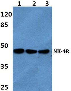 Invitrogen NK-4R Polyclonal Antibody 100 &mu;L; Unconjugated:Antibodies,