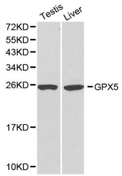 Invitrogen GPX5 Polyclonal Antibody 100 &mu;L; Unconjugated:Antibodies,