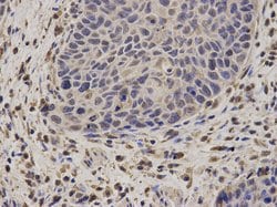 Invitrogen NCF2 Polyclonal Antibody 100 &mu;L; Unconjugated:Antibodies,