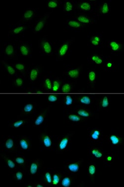 Invitrogen SELENBP1 Polyclonal Antibody 100 &mu;L; Unconjugated:Antibodies,