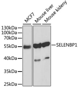 Invitrogen SELENBP1 Polyclonal Antibody 100 &mu;L; Unconjugated:Antibodies,