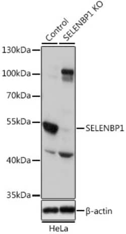 Invitrogen SELENBP1 Polyclonal Antibody 100 &mu;L; Unconjugated:Antibodies,