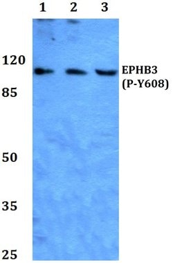 Invitrogen Phospho-EphB3 (Tyr608) Polyclonal Antibody 100 &mu;L; Unconjugated:Antibodies,