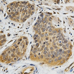 ABO Polyclonal Antibody:Antibodies, Polyclonal
