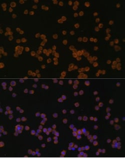 CHI3L1 Polyclonal Antibody:Antibodies, Polyclonal