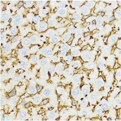 CHI3L1 Polyclonal Antibody:Antibodies, Polyclonal