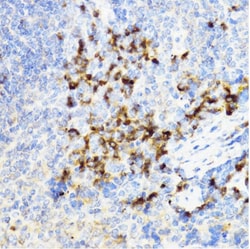 CHI3L1 Polyclonal Antibody:Antibodies, Polyclonal