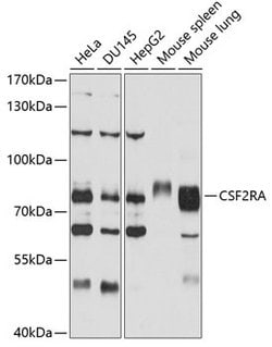 Invitrogen CSF2RA Polyclonal Antibody 100 &mu;L; Unconjugated:Antibodies,