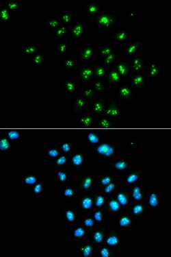 Invitrogen eIF6 Polyclonal Antibody 100 &mu;L; Unconjugated:Antibodies,
