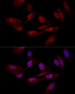Invitrogen eIF6 Polyclonal Antibody 100 &mu;L; Unconjugated:Antibodies,