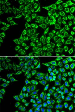 Invitrogen LIPC Polyclonal Antibody 100 &mu;L; Unconjugated:Antibodies,
