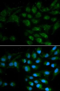 Invitrogen LIPC Polyclonal Antibody 100 &mu;L; Unconjugated:Antibodies,