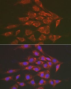 Invitrogen Sorbitol Dehydrogenase Polyclonal Antibody 100 &mu;L; Unconjugated:Antibodies,