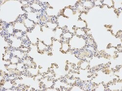 Invitrogen Sorbitol Dehydrogenase Polyclonal Antibody 100 &mu;L; Unconjugated:Antibodies,