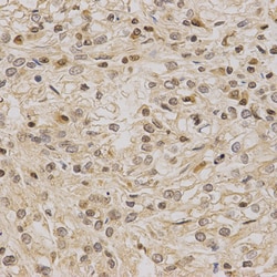 Invitrogen LETMD1 Polyclonal Antibody 100 &mu;L; Unconjugated:Antibodies,
