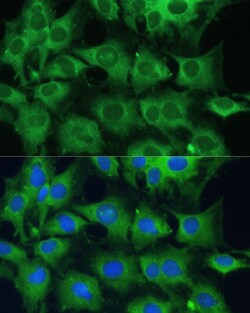 Invitrogen PTPN22 Polyclonal Antibody 100 &mu;L; Unconjugated:Antibodies,