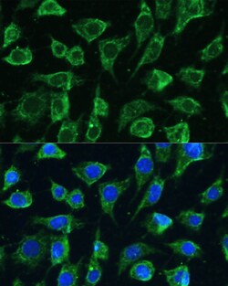 Invitrogen PTPN22 Polyclonal Antibody 100 &mu;L; Unconjugated:Antibodies,