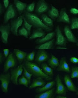 Invitrogen PTPN22 Polyclonal Antibody 100 &mu;L; Unconjugated:Antibodies,