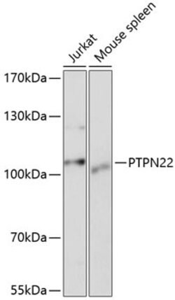 Invitrogen PTPN22 Polyclonal Antibody 100 &mu;L; Unconjugated:Antibodies,