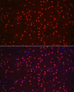 Invitrogen NeuN Polyclonal Antibody 100 &mu;L | Buy Online | Invitrogen&trade; | Fisher Scientific