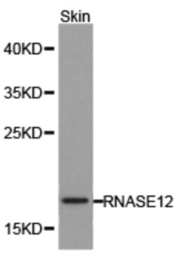 Invitrogen RNase12 Polyclonal Antibody 100 &mu;L; Unconjugated:Antibodies,