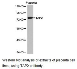 Invitrogen TAP2 Polyclonal Antibody 100 &mu;L | Buy Online | Invitrogen&trade; | Fisher Scientific