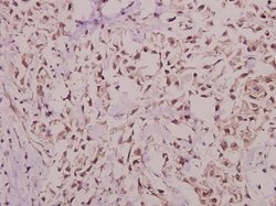 Invitrogen Hairless Polyclonal Antibody 100 &mu;L; Unconjugated:Antibodies,