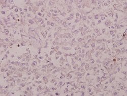 Invitrogen CRSP130 Polyclonal Antibody 100 &mu;L; Unconjugated:Antibodies,