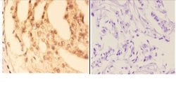 Invitrogen COL19A1 Polyclonal Antibody 100 &mu;L; Unconjugated:Antibodies,