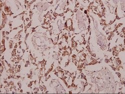 Invitrogen GCP3 Polyclonal Antibody 100 &mu;L; Unconjugated:Antibodies,