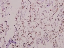 KV4.1 (KCND1) Polyclonal Antibody, Invitrogen 100 &mu;L; Unconjugated:Antibodies,