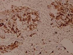 Invitrogen SPINK5 Polyclonal Antibody 100 μL; Unconjugated:Antibodies,