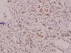 Invitrogen SH2D2A Polyclonal Antibody 100 &mu;L | Buy Online | Invitrogen&trade; | Fisher Scientific