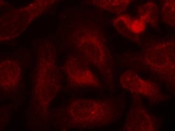 Invitrogen Phospho-ABL1/ABL2 (Tyr393, Tyr439) Polyclonal Antibody 100 &mu;L;