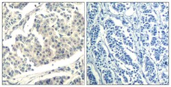 Invitrogen Phospho-ABL1/ABL2 (Tyr393, Tyr439) Polyclonal Antibody 100 &mu;L;