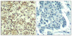Invitrogen Phospho-AKT1 (Thr450) Polyclonal Antibody 100 &mu;L; Unconjugated:Antibodies,