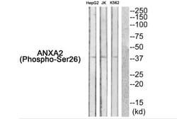 Invitrogen Phospho-Annexin A2 (Ser26) Polyclonal Antibody 100 &mu;L | Buy Online | Invitrogen&trade; | Fisher Scientific