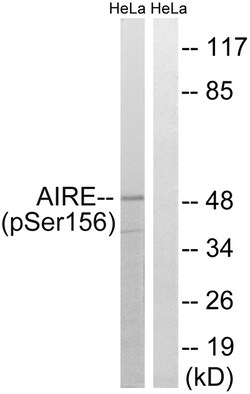 Invitrogen Phospho-AIRE (Ser156) Polyclonal Antibody 100 &mu;L | Buy Online | Invitrogen&trade; | Fisher Scientific
