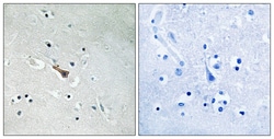 Invitrogen Phospho-APLP2 (Tyr755) Polyclonal Antibody 100 &mu;L; Unconjugated:Antibodies,