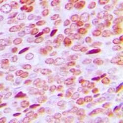 Invitrogen Phospho-Androgen Receptor (Ser213) Polyclonal Antibody 100 &mu;L;