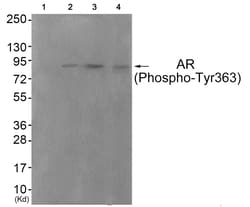 Invitrogen Phospho-Androgen Receptor (Tyr363) Polyclonal Antibody 100 &mu;L;