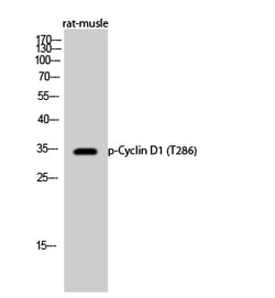 Invitrogen Phospho-Cyclin D1 (Thr286) Polyclonal Antibody 100 &mu;L; Unconjugated:Anticuerpos