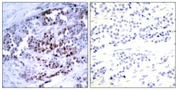 Invitrogen Phospho-Bcl-2 (Ser70) Polyclonal Antibody 100 &mu;L; Unconjugated:Antibodies,