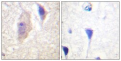 Invitrogen Phospho-BCR (Tyr360) Polyclonal Antibody 100 &mu;L | Buy Online | Invitrogen&trade; | Fisher Scientific