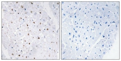 Invitrogen Phospho-Blooms Syndrome (Thr99) Polyclonal Antibody 100 &mu;L;