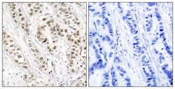 Invitrogen Phospho-BRCA1 (Ser1524) Polyclonal Antibody 100 &mu;L; Unconjugated:Antibodies,